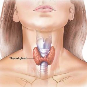 Hypothyroidism